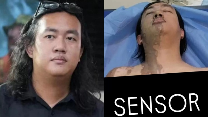 Aktivis Kontras Andrie Yunus - Repro -