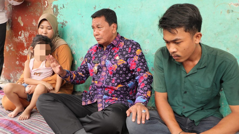 Bupati Tangerang Jamin Pengobatan Anak Penderita Kanker Mata