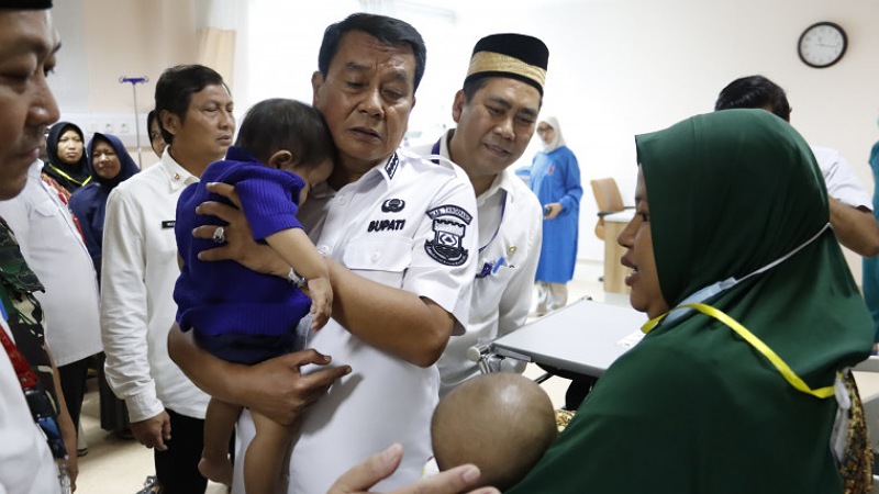 Ditinjau Bupati! RSUD Balaraja Gelar Operasi Bibir Sumbing Gratis